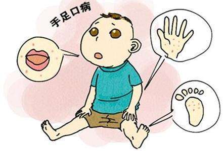 春意盎然，勿忘防治手足口